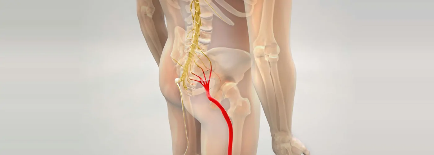 Sciatica – Ayurveda, Siddha & Homeopathy Treatment