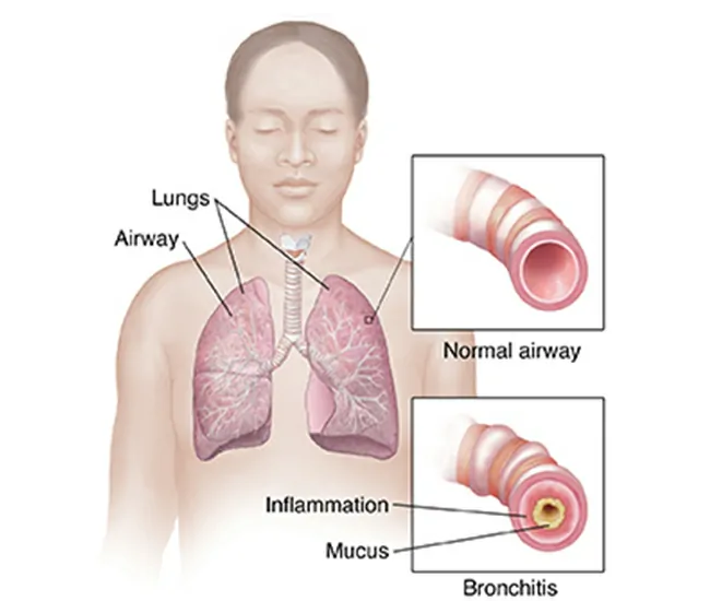  Physiotherapy Treatment