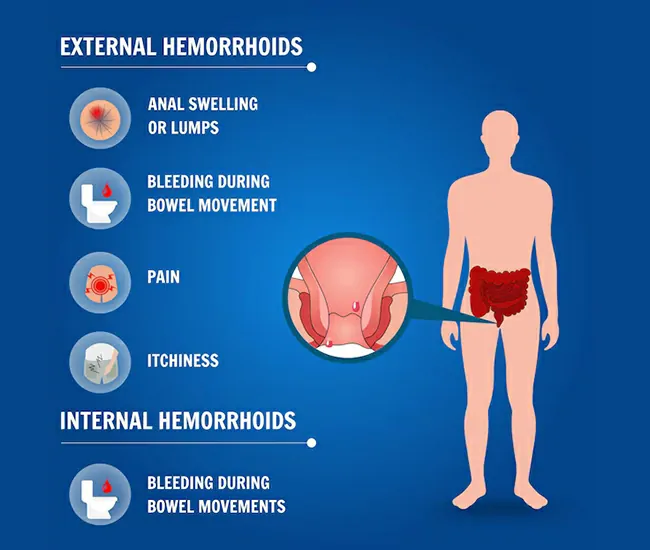  Homeopathic Treatment