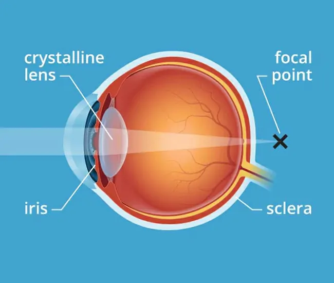 Diet and Lifestyle Recommendations
