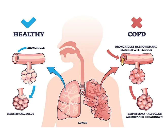  Homeopathic Treatment