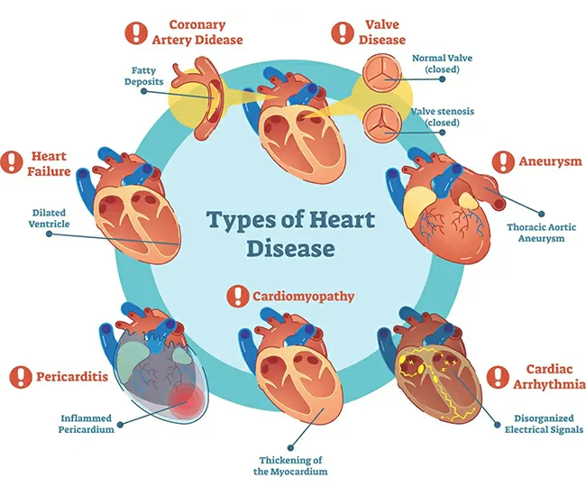 Causes & Risk Factors of Heart Disease