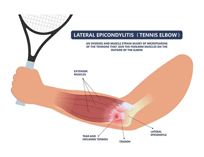  Physiotherapy  Treatment