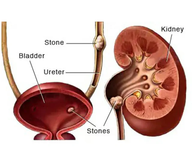  Homeopathic Treatment