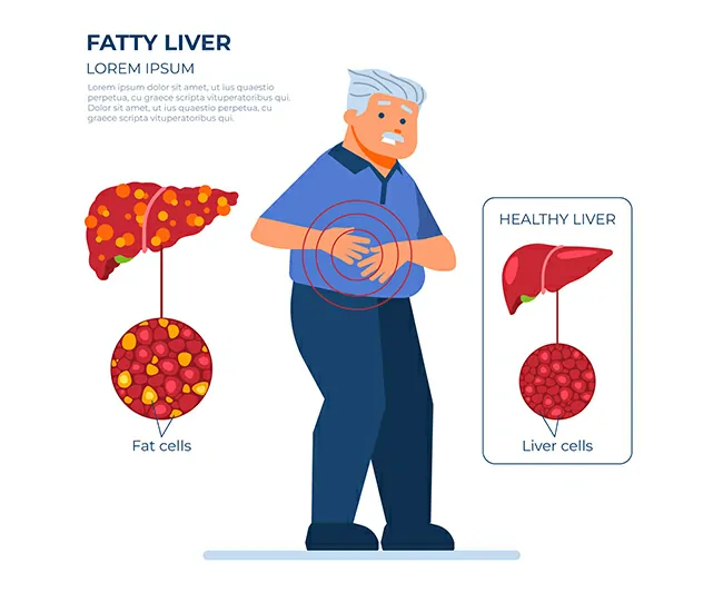 Causes of High Cholesterol