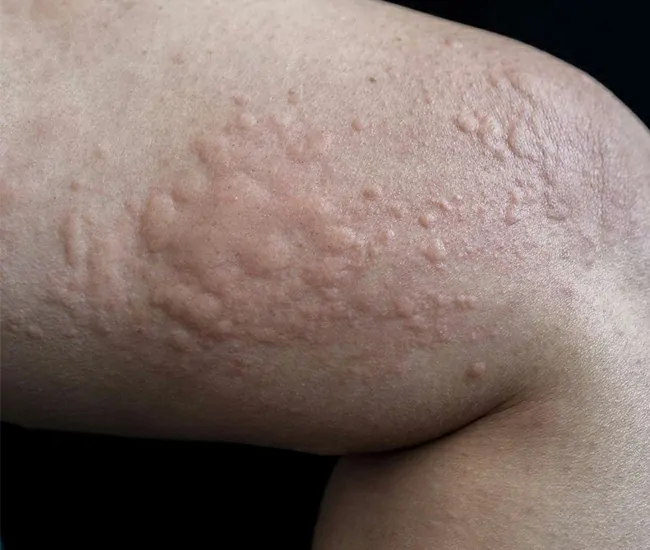  Homeopathy Treatment