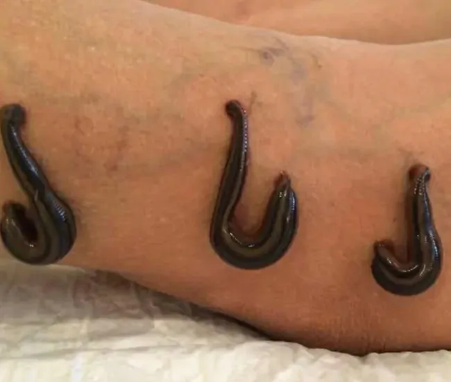 How Attai Viduthal Works?