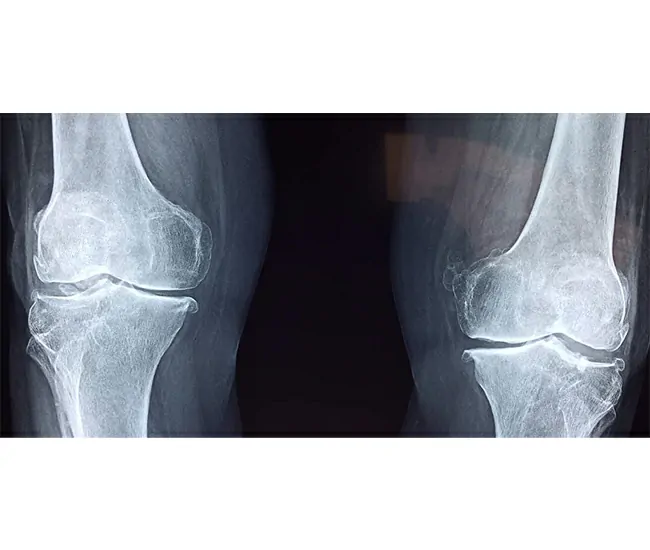  Homeopathy Treatment