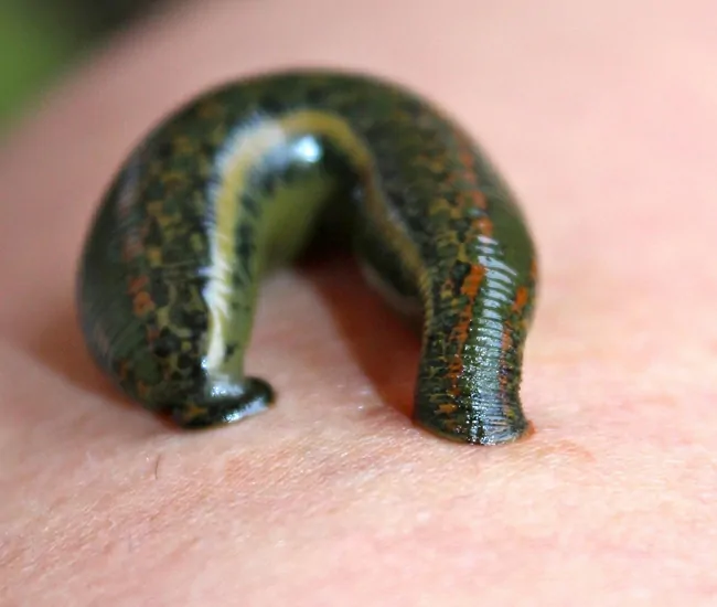 What is Raktha Mokshanam