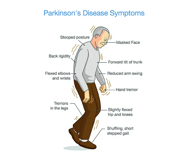 What is Parkinson’s Disease?