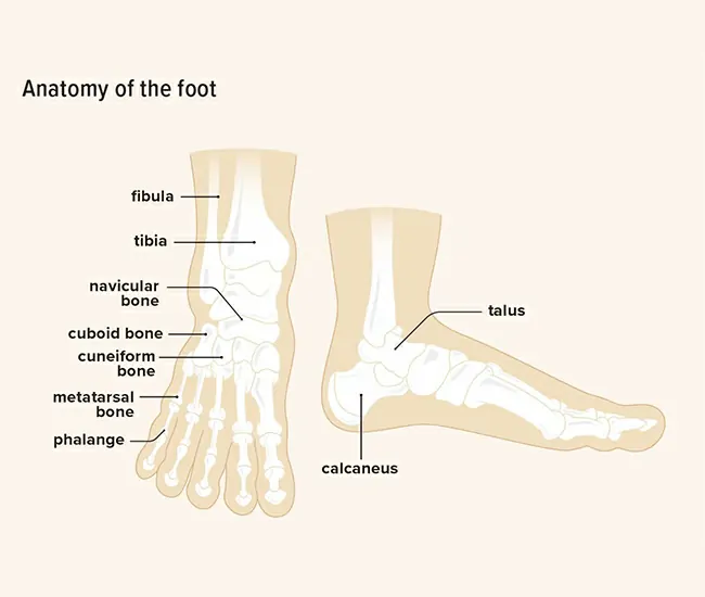 Symptoms of Calcaneal Spur & Plantar Fasciitis