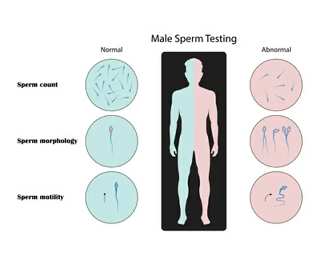 Semen Analysis & Types of Abnormal Reports