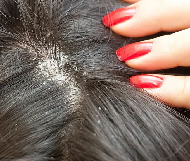  Homeopathy Treatment