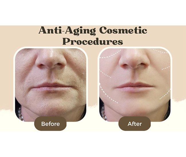  Homeopathy Treatment