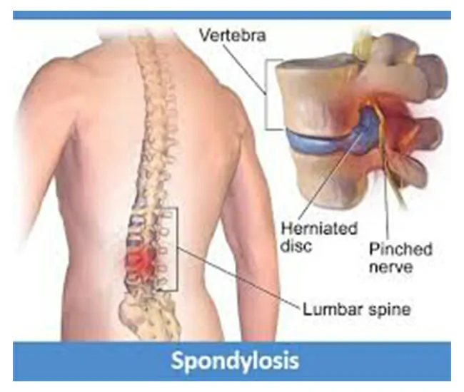  Siddha Treatment