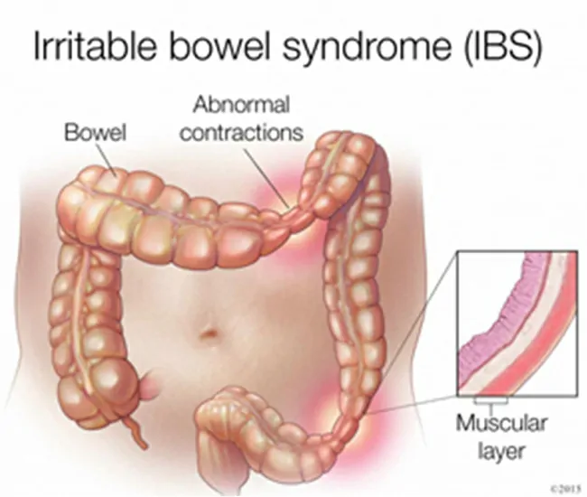  Homeopathic Treatment