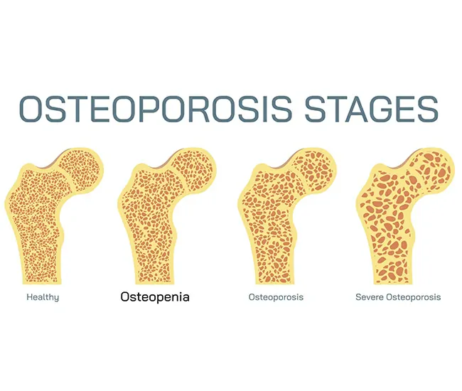  Physiotherapy  Treatment