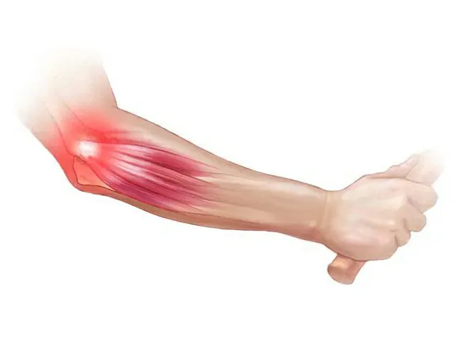  Homeopathic Treatment