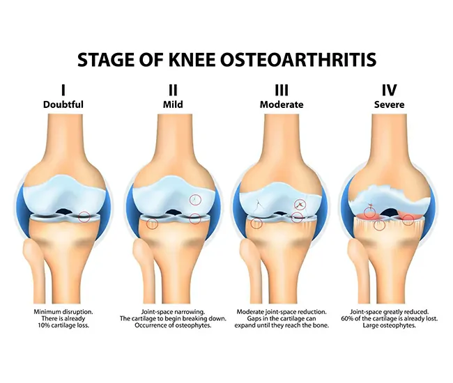 Physiotherapy Treatment