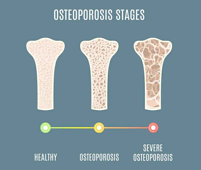  Homeopathic Treatment