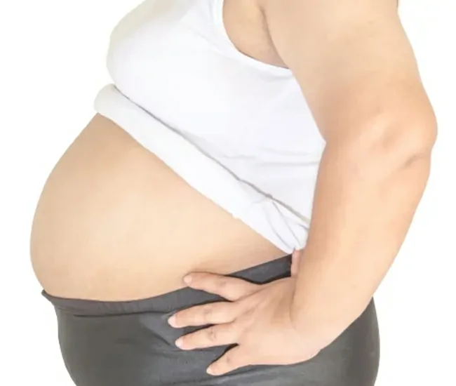 Health Risks of Obesity in Women
