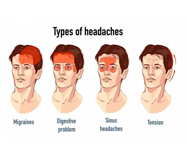 Symptoms of Migraine & Headaches
