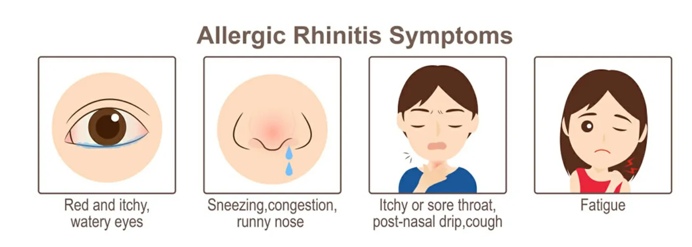 Sinusitis & Allergic Rhinitis – Causes, Symptoms & Holistic Treatments