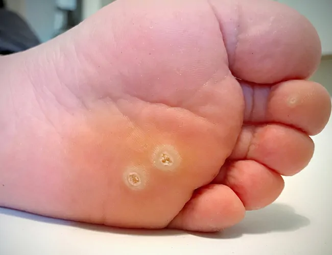  Homeopathic Treatment