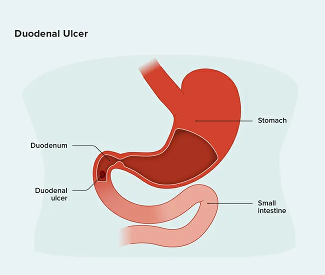  Homeopathic Treatment