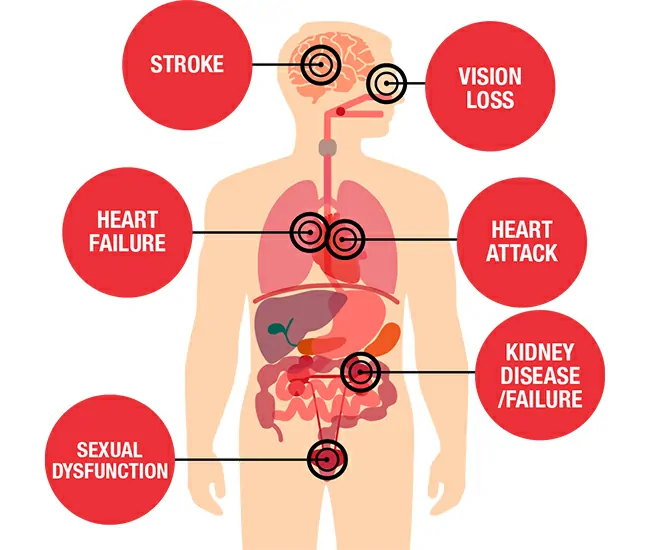 Organs Affected by Hypertension