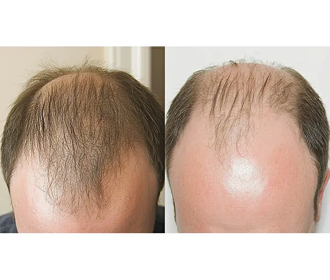  Homeopathy Treatment