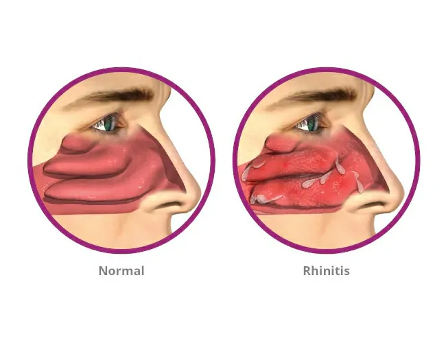  Homeopathy Treatment