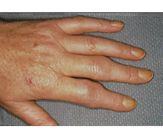  Homeopathy Treatment