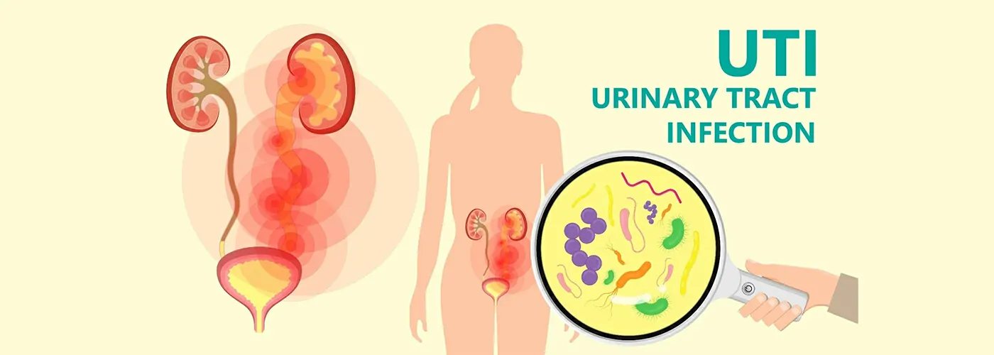 Urinary Tract Infection (UTI) – Causes, Symptoms, Types & Holistic Treatment