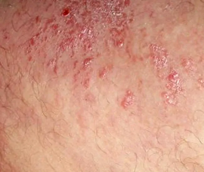  Homeopathy Treatment