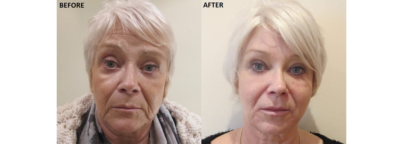 Anti-Aging – Causes, Symptoms & Natural Healing with Ayurveda, Siddha & Panchakarma