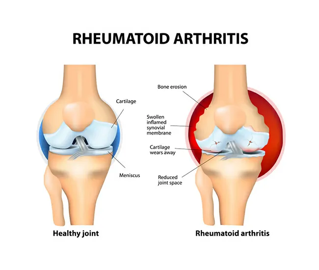  Ayurvedic Treatments