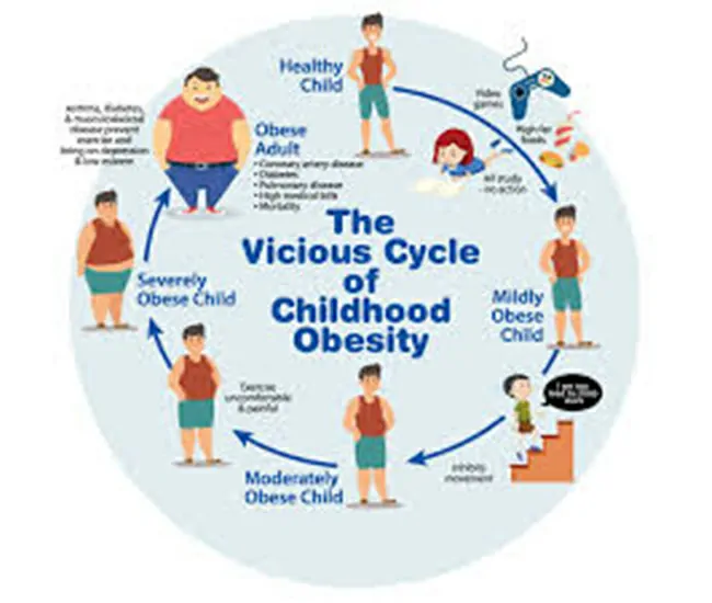 Causes of Childhood Obesity