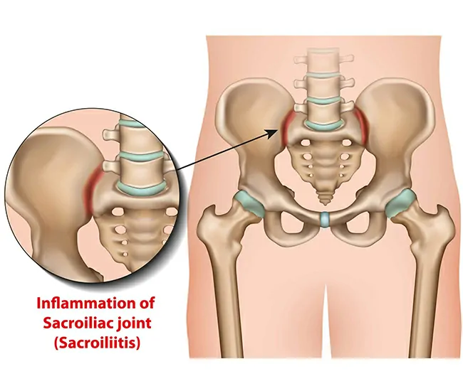  Physiotherapy Treatment