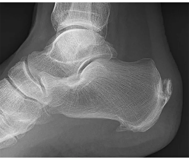  Homeopathic Treatment