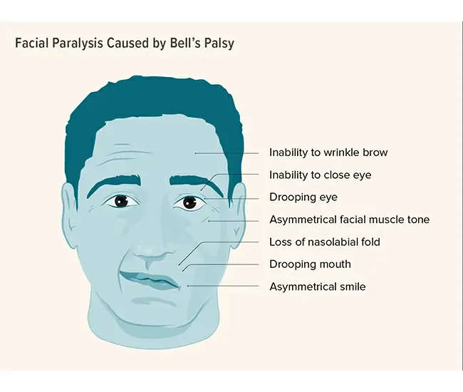  Homeopathic Treatment