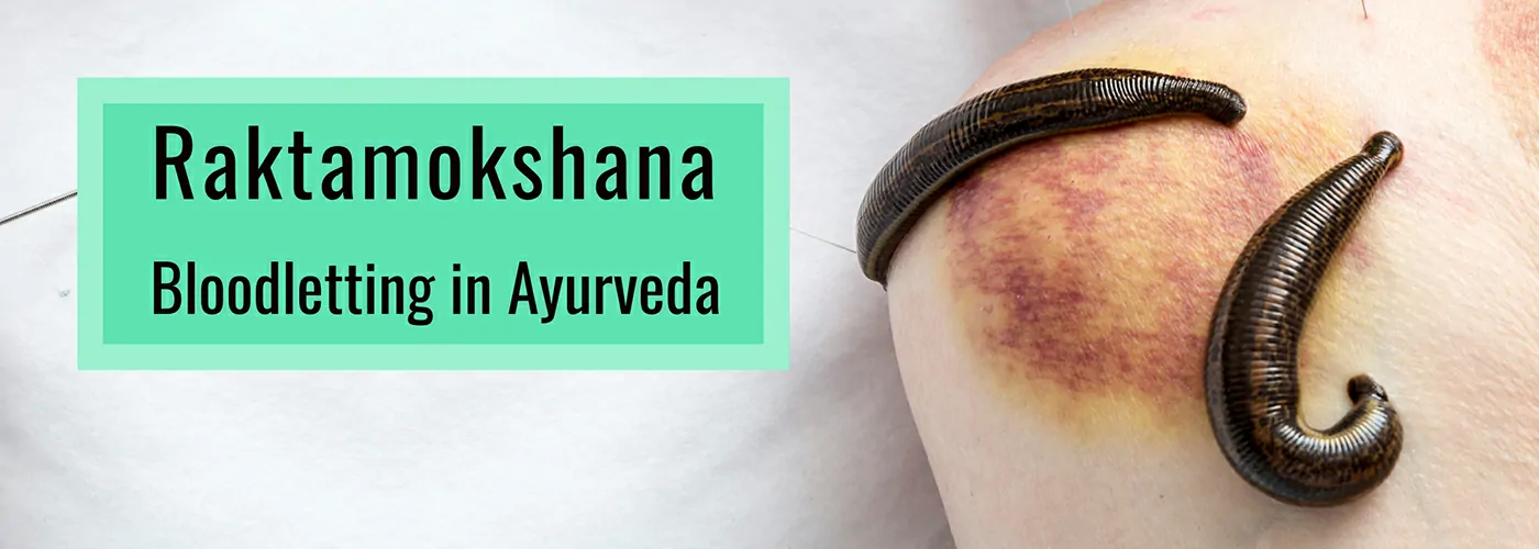 Raktha Mokshanam – Ayurvedic Blood Purification Therapy