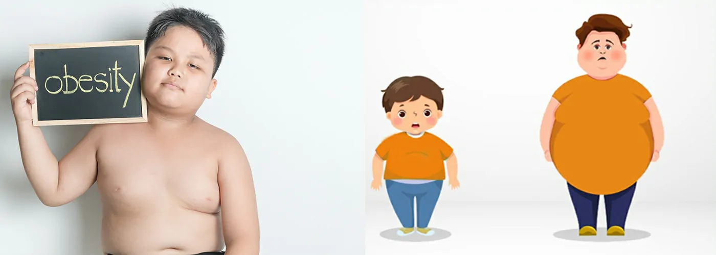 Childhood Obesity – Ayurveda, Siddha, Homeopathy & Natural Healing