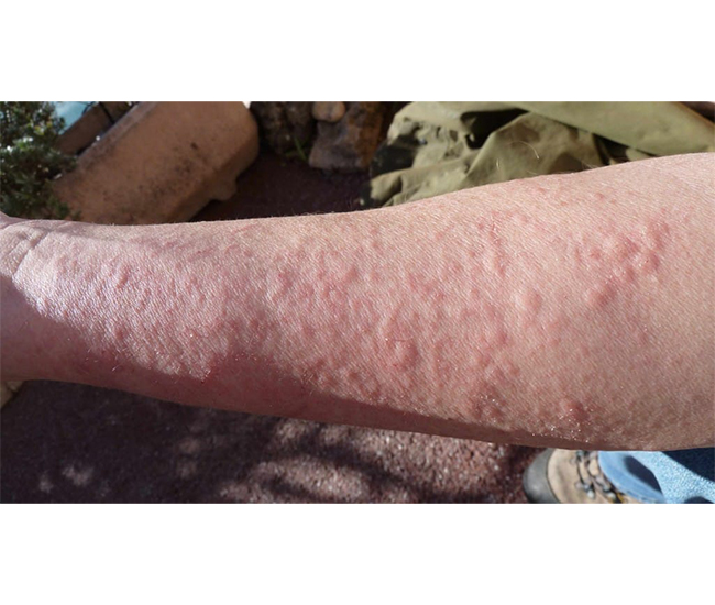  Homeopathy Treatment