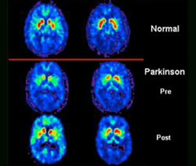  Homeopathic Treatment