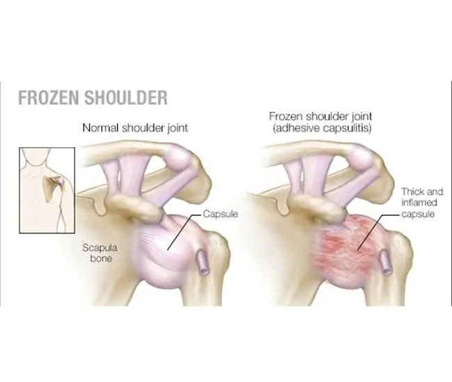  Physiotherapy  Treatment