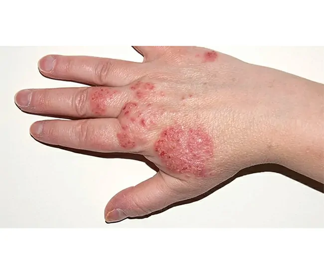  Homeopathy Treatment